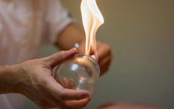 Coppettazione russa